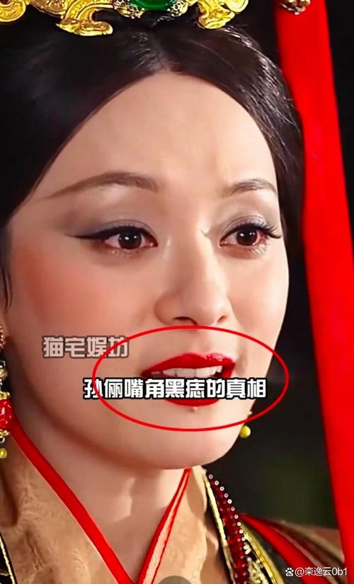 2025新澳正版今晚资料网站和孙俪唇下痣没了与孙俪嘴唇的痣