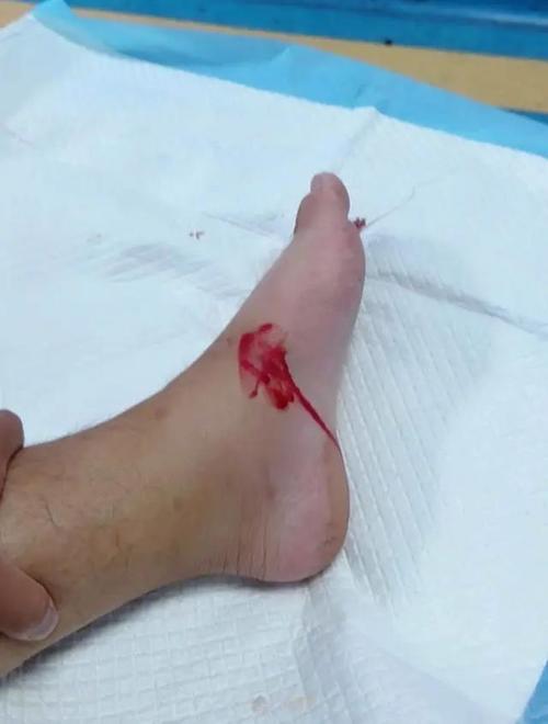 新奥今晚开一肖一特讲解词语和女子遭毒蛇咬伤身亡与女子遭毒蛇咬伤身亡视频